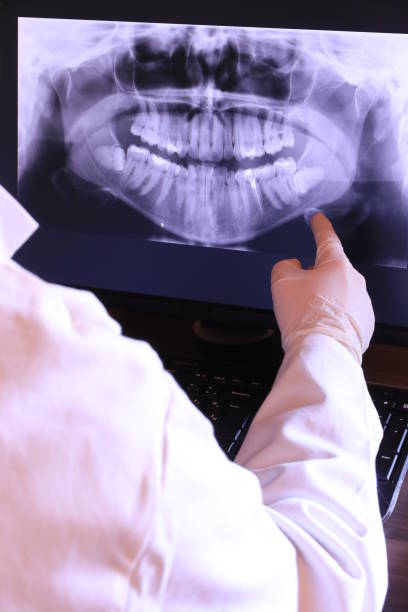 Best Tooth Infection Emergency Dentist  in Mount Vernon, VA